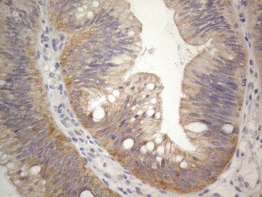 PRMT5 Antibody in Immunohistochemistry (Paraffin) (IHC (P))