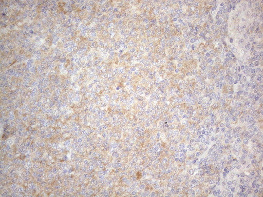 PRMT5 Antibody in Immunohistochemistry (Paraffin) (IHC (P))