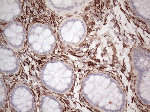 PROCR Antibody in Immunohistochemistry (Paraffin) (IHC (P))