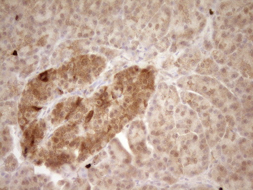 PROCR Antibody in Immunohistochemistry (Paraffin) (IHC (P))