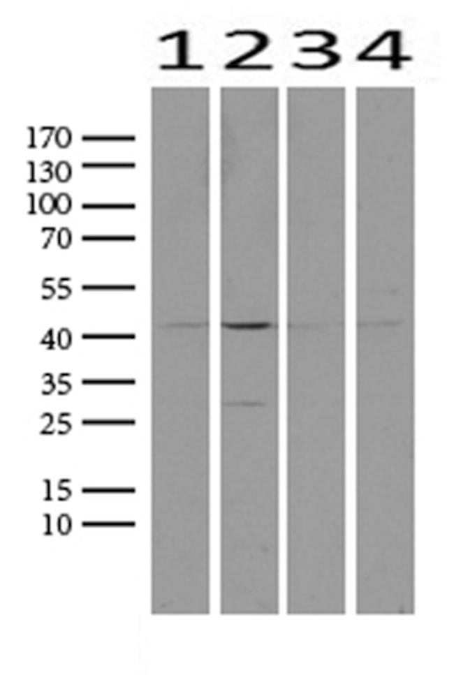 PROCR Antibody in Western Blot (WB)