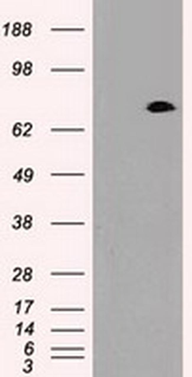 PROM2 Antibody in Western Blot (WB)