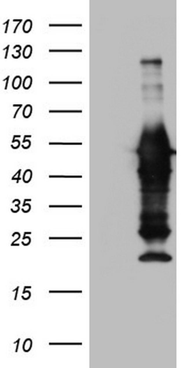 PRPH Antibody in Western Blot (WB)