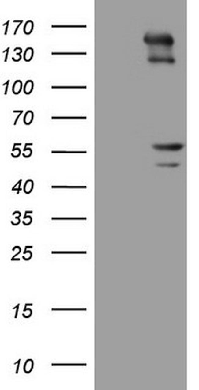 PRPH Antibody in Western Blot (WB)