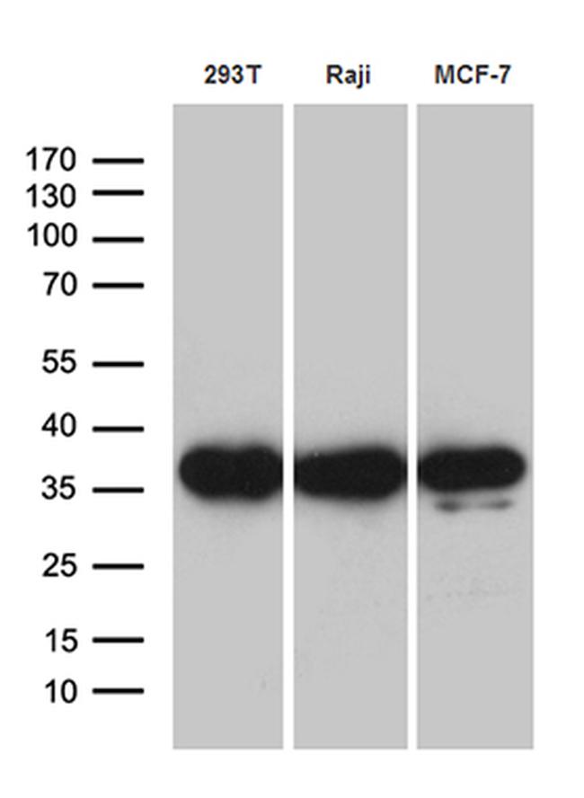 PRPS1L1 Antibody in Western Blot (WB)