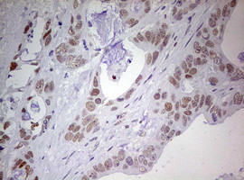 PRRX1 Antibody in Immunohistochemistry (Paraffin) (IHC (P))