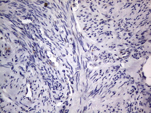 PRRX1 Antibody in Immunohistochemistry (Paraffin) (IHC (P))