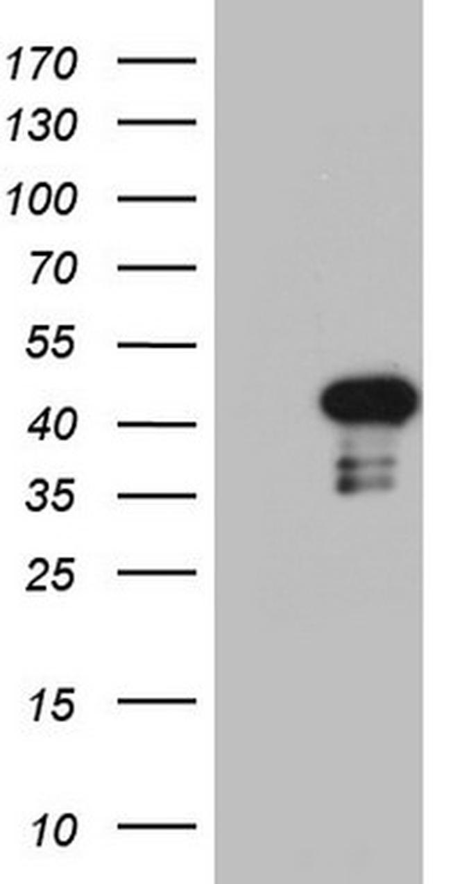 PRRX1 Antibody in Western Blot (WB)