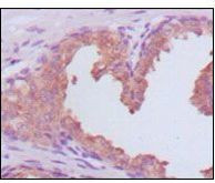 PSA Antibody in Immunohistochemistry (Paraffin) (IHC (P))