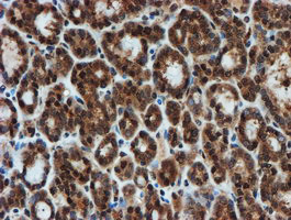 PSMA6 Antibody in Immunohistochemistry (Paraffin) (IHC (P))