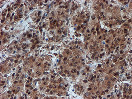 PSMA6 Antibody in Immunohistochemistry (Paraffin) (IHC (P))