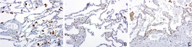 PSMA6 Antibody in Immunohistochemistry (Paraffin) (IHC (P))