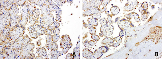 PSMA6 Antibody in Immunohistochemistry (Paraffin) (IHC (P))