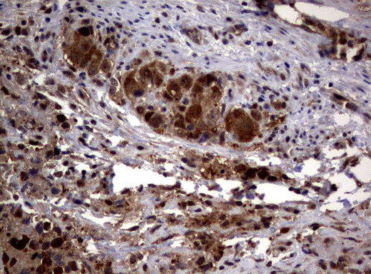 PSMA6 Antibody in Immunohistochemistry (Paraffin) (IHC (P))