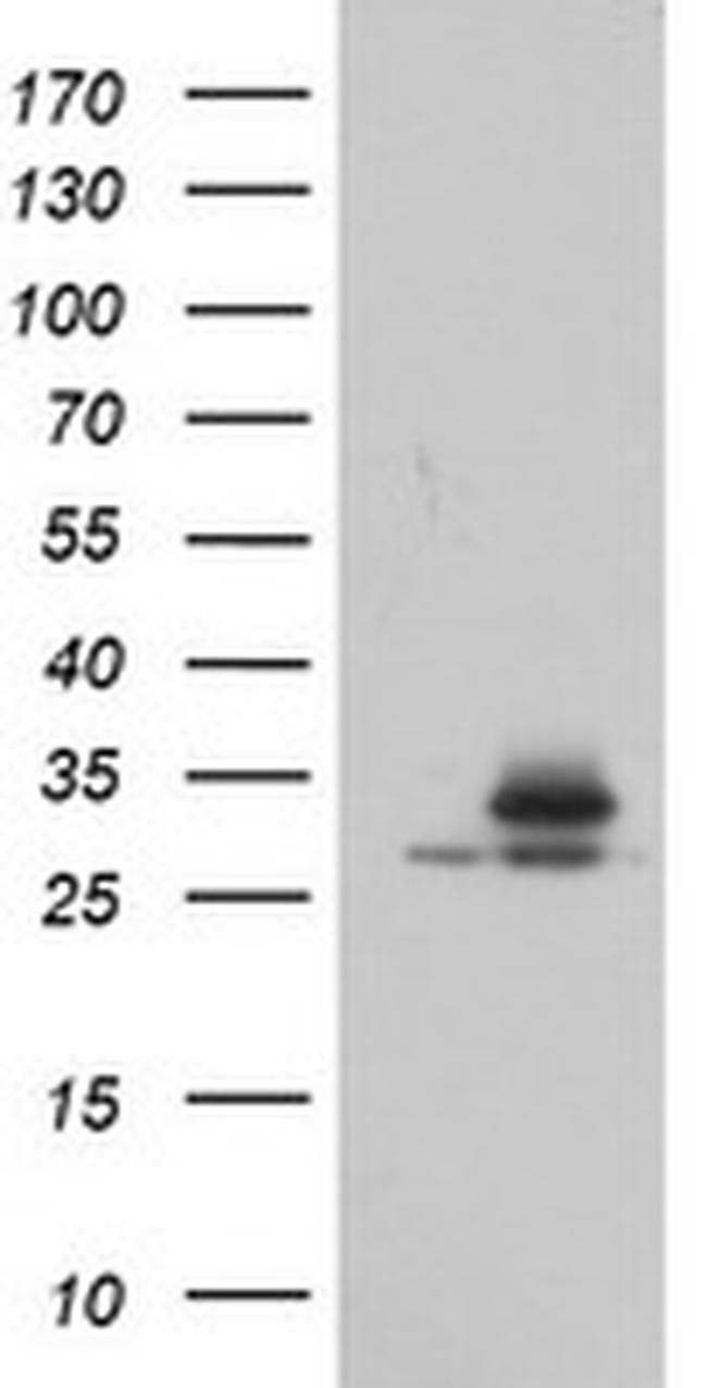 PSMA6 Antibody in Western Blot (WB)