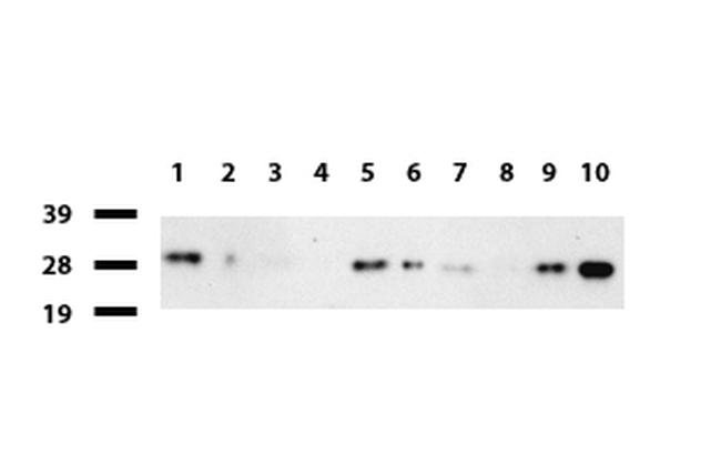 PSMA6 Antibody in Western Blot (WB)