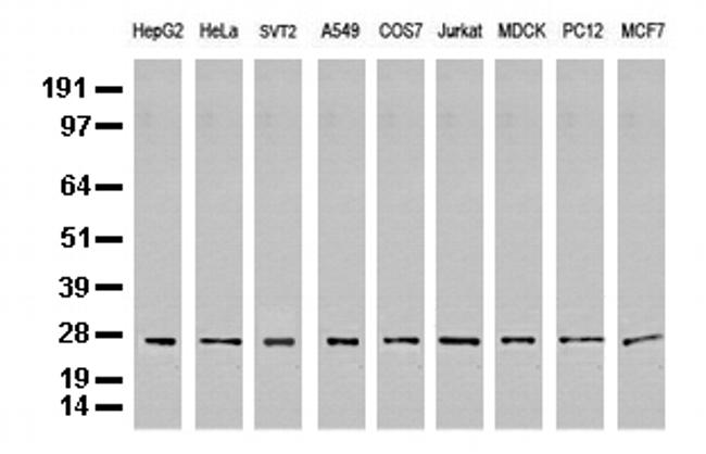 PSMA6 Antibody in Western Blot (WB)