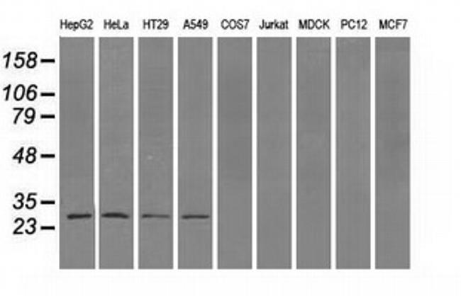 PSMA7 Antibody in Western Blot (WB)