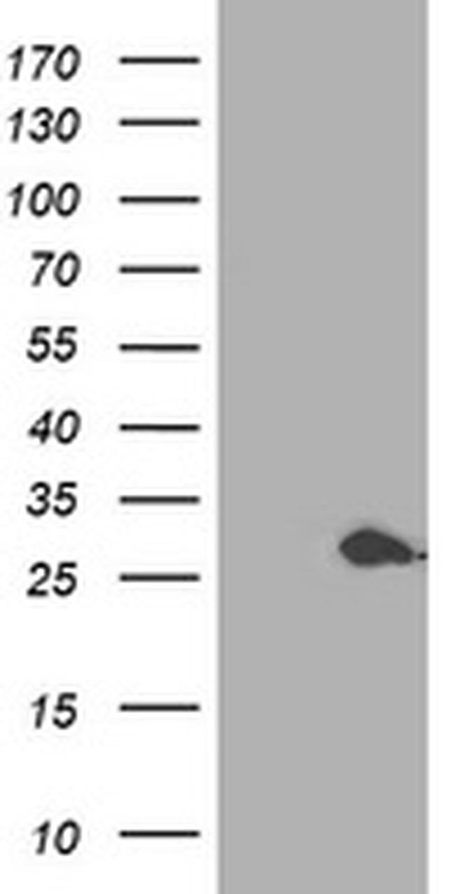 PSMB4 Antibody in Western Blot (WB)