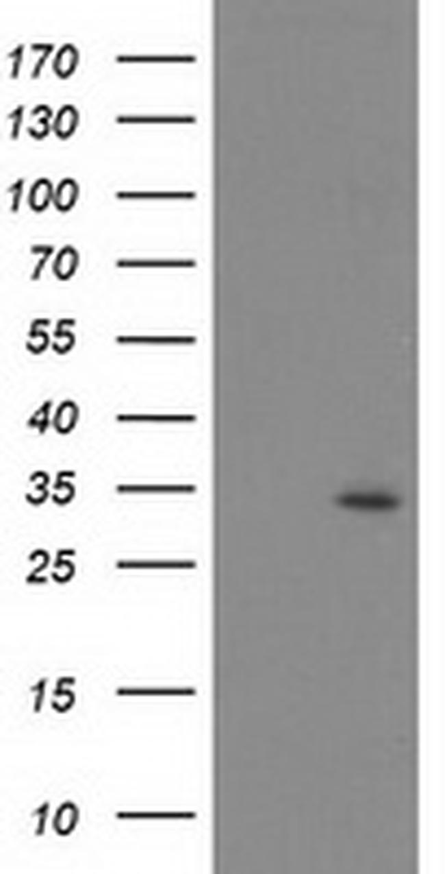 PSMB4 Antibody in Western Blot (WB)