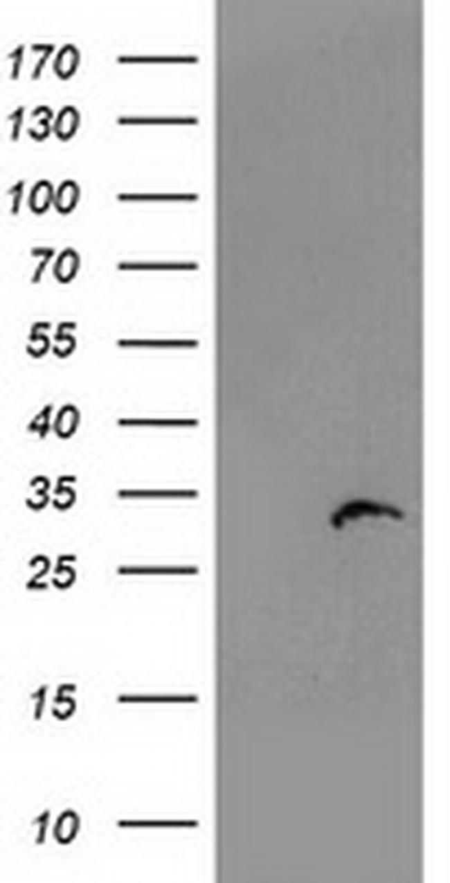 PSMB4 Antibody in Western Blot (WB)