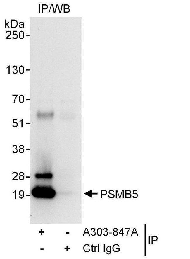 PSMB5 Antibody in Western Blot (WB)