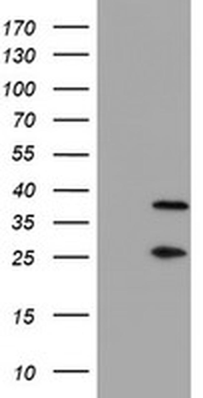 PSMB7 Antibody in Western Blot (WB)