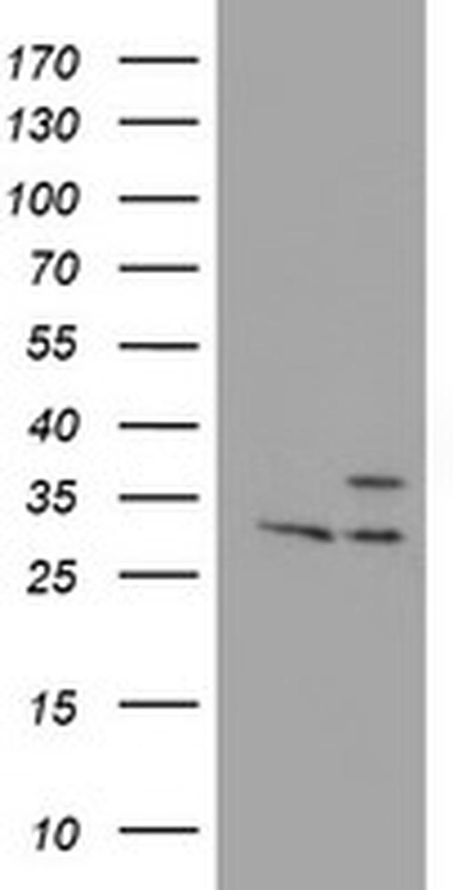 PSMB7 Antibody in Western Blot (WB)