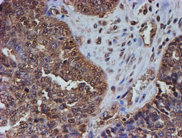 PSMB9 Antibody in Immunohistochemistry (Paraffin) (IHC (P))