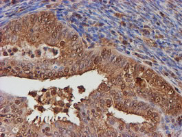 PSMB9 Antibody in Immunohistochemistry (Paraffin) (IHC (P))