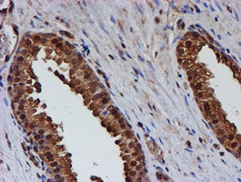 PSMB9 Antibody in Immunohistochemistry (Paraffin) (IHC (P))