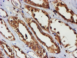 PSMB9 Antibody in Immunohistochemistry (Paraffin) (IHC (P))