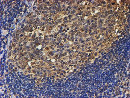 PSMB9 Antibody in Immunohistochemistry (Paraffin) (IHC (P))