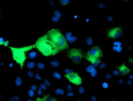 PSMD2 Antibody in Immunocytochemistry (ICC/IF)