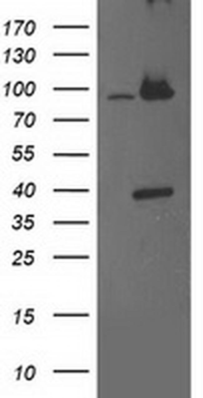 PSMD2 Antibody in Western Blot (WB)