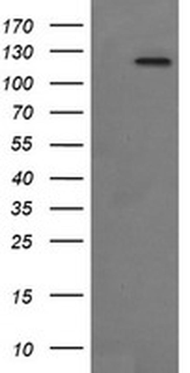 PTK2 Antibody in Western Blot (WB)