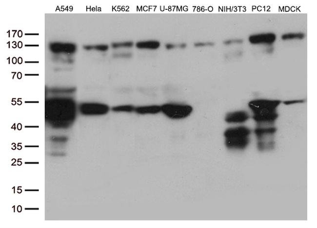 PTK2 Monoclonal Antibody (OTI4G7) (CF506182)