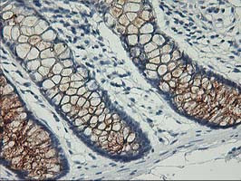 PVRL1 Antibody in Immunohistochemistry (Paraffin) (IHC (P))