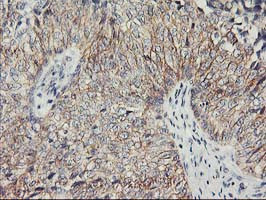 PVRL1 Antibody in Immunohistochemistry (Paraffin) (IHC (P))