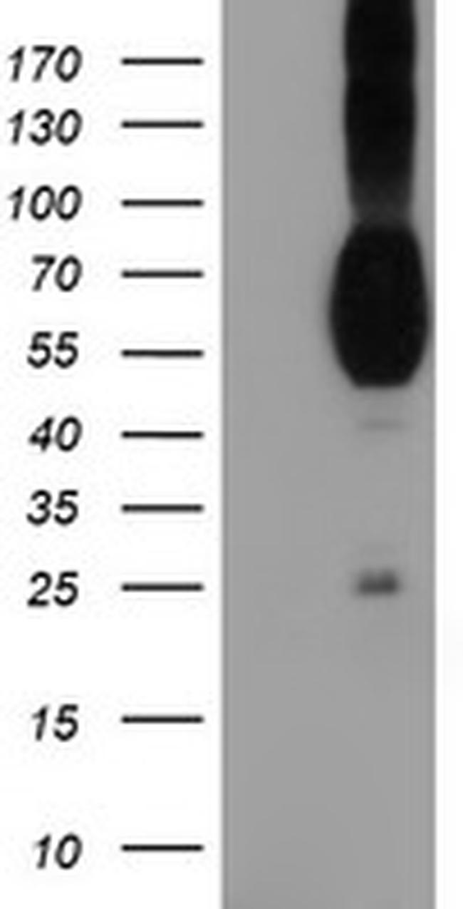 PVRL1 Antibody in Western Blot (WB)