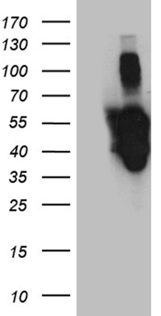 PXN Antibody in Western Blot (WB)