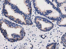 PYCR2 Antibody in Immunohistochemistry (Paraffin) (IHC (P))