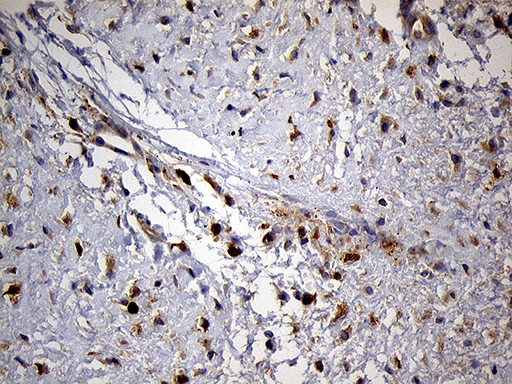 PYGM Antibody in Immunohistochemistry (Paraffin) (IHC (P))