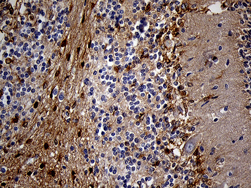 PYGM Antibody in Immunohistochemistry (Paraffin) (IHC (P))