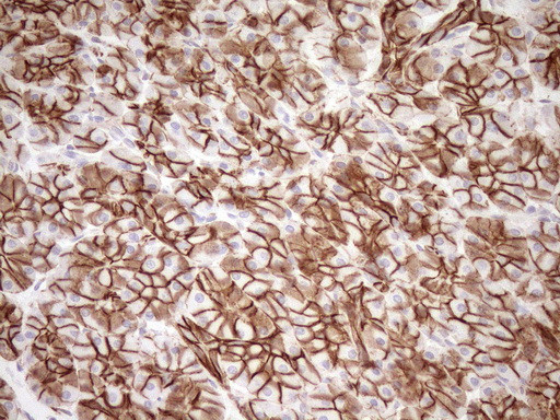 Pan-CDH Antibody in Immunohistochemistry (Paraffin) (IHC (P))