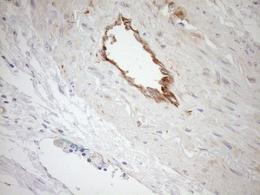 Pan-CDH Antibody in Immunohistochemistry (Paraffin) (IHC (P))