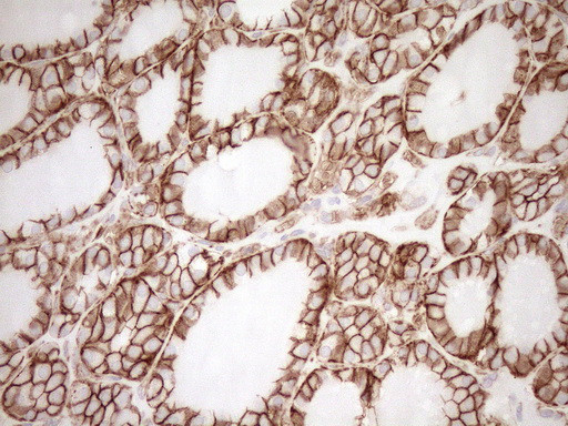 Pan-CDH Antibody in Immunohistochemistry (Paraffin) (IHC (P))