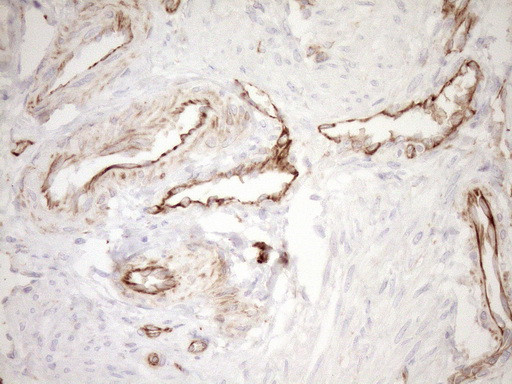 Pan-CDH Antibody in Immunohistochemistry (Paraffin) (IHC (P))