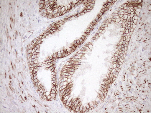 Pan-CDH Antibody in Immunohistochemistry (Paraffin) (IHC (P))