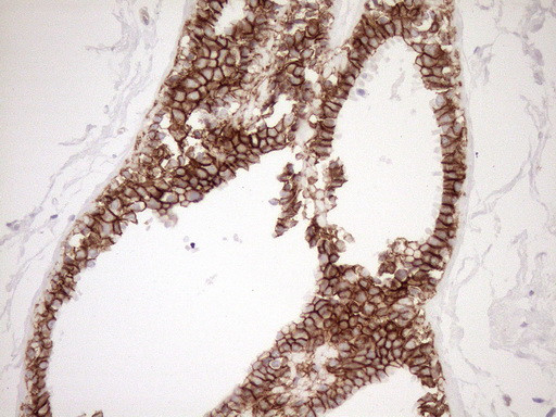 Pan-CDH Antibody in Immunohistochemistry (Paraffin) (IHC (P))